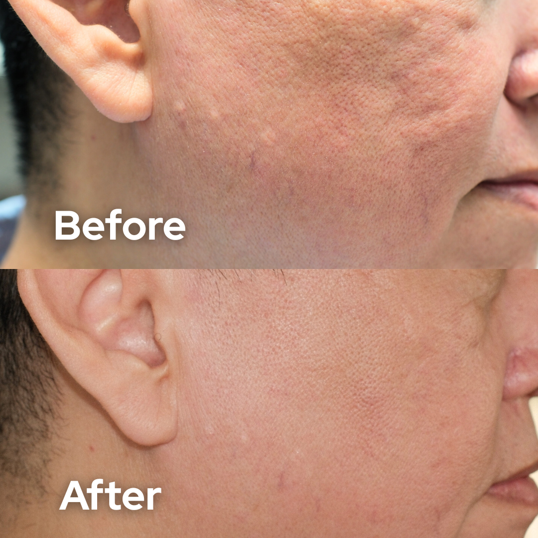 Facial Repair Serum