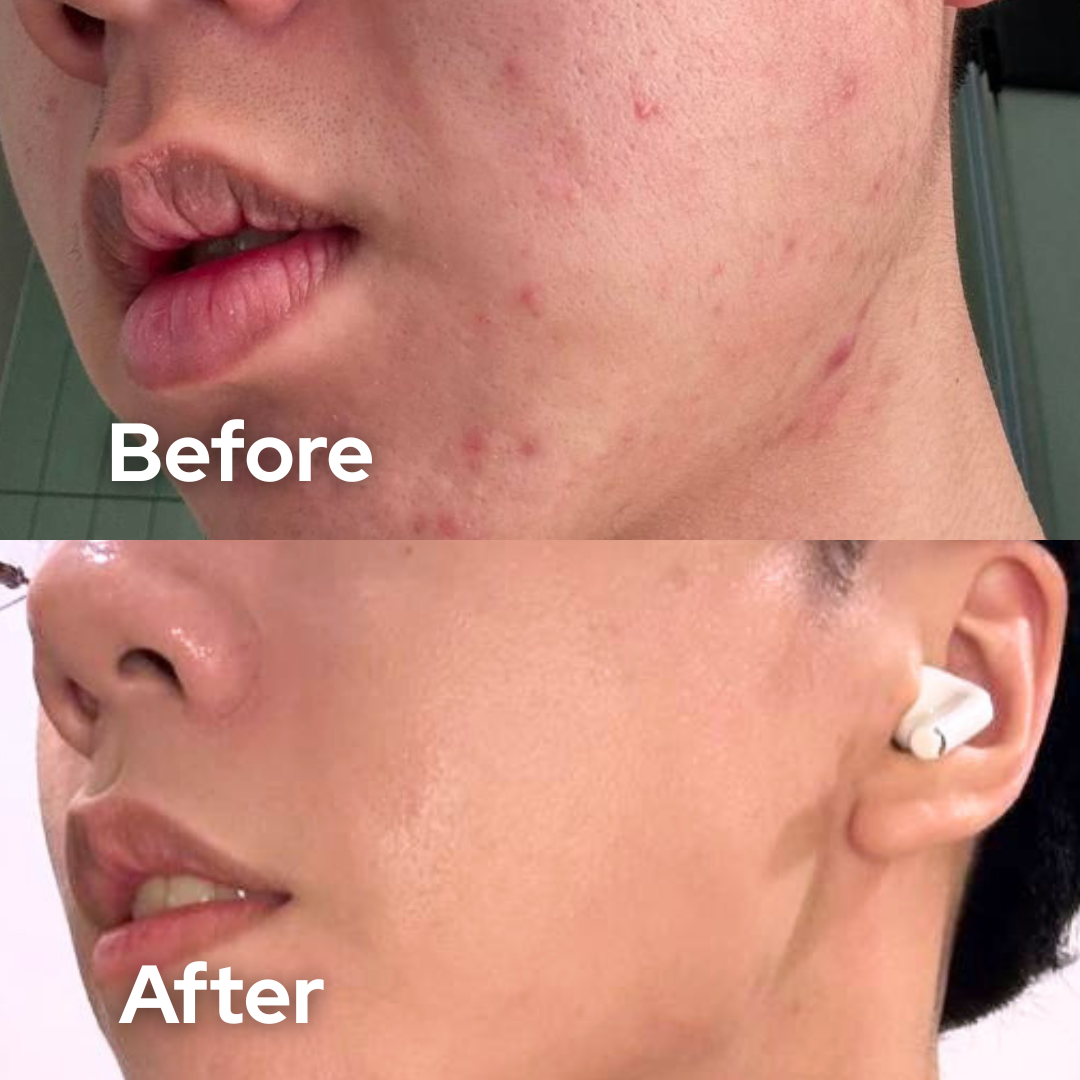 Facial Repair Serum