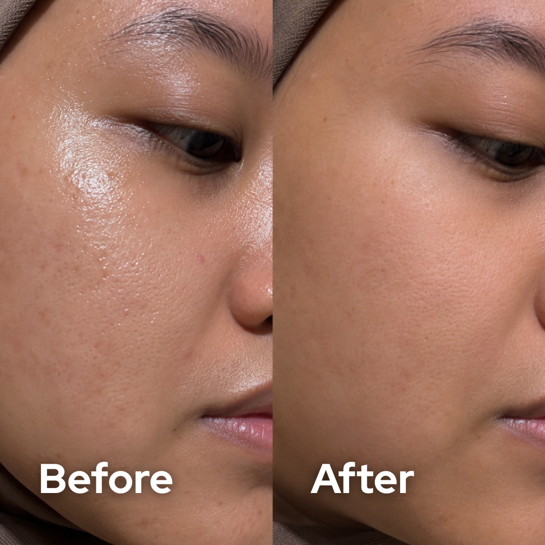Facial Repair Serum
