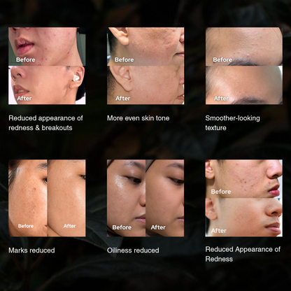 Facial Repair Serum